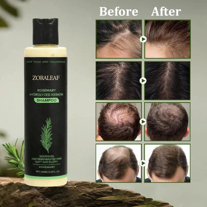 ZORALEAF Rosemary Hydrolyzed Keratin Shampoo